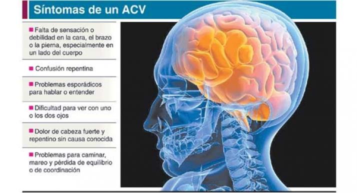 Cómo reconocer los síntomas del ACV