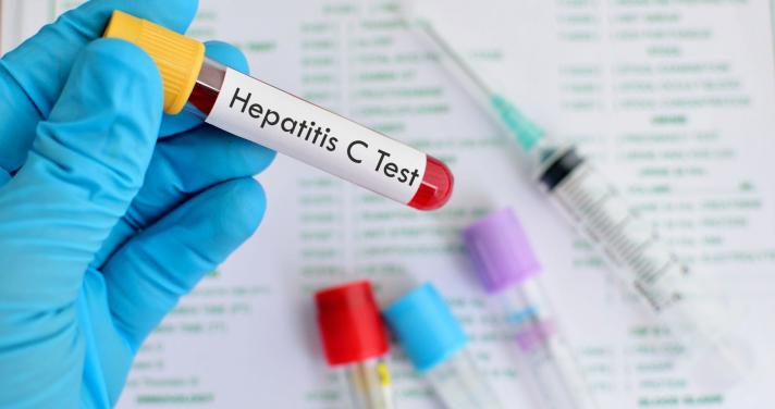 ¿Qué es la hepatitis C?
